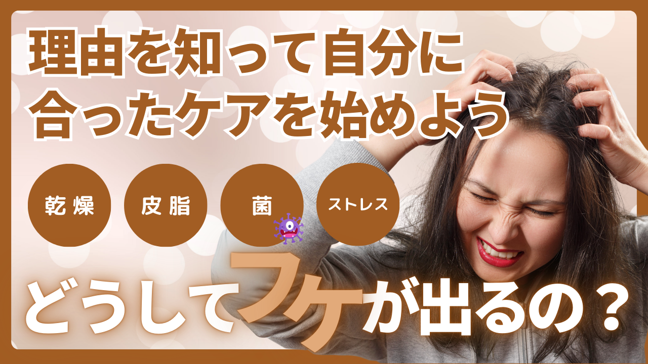 どうしてフケが出るの？理由を知って自分に合ったケアを始めよう